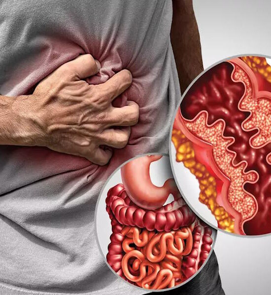 crohn's disease