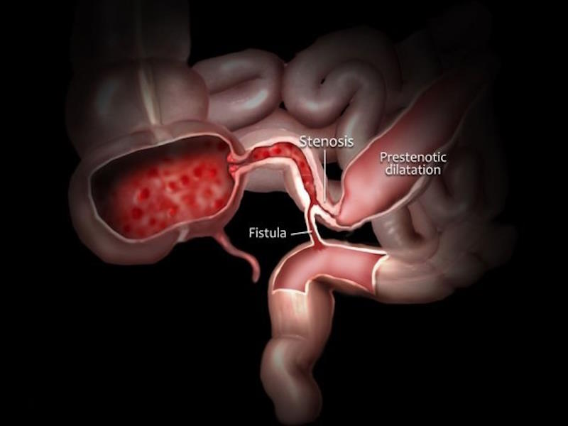 Education and advocacy